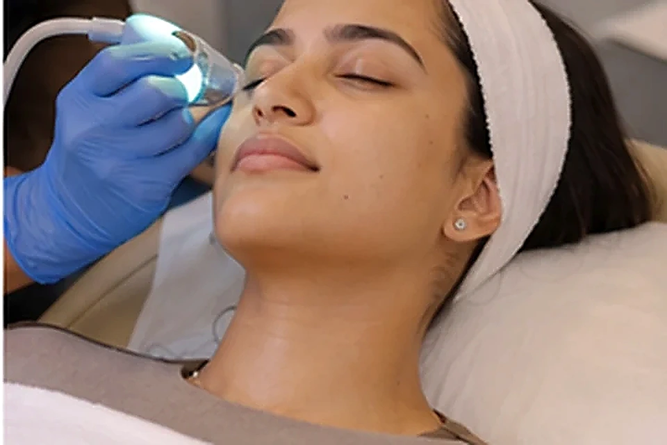 Cooling facial session related to Glycolic Peel at Nadhira Cosmo Clinic, Avadi